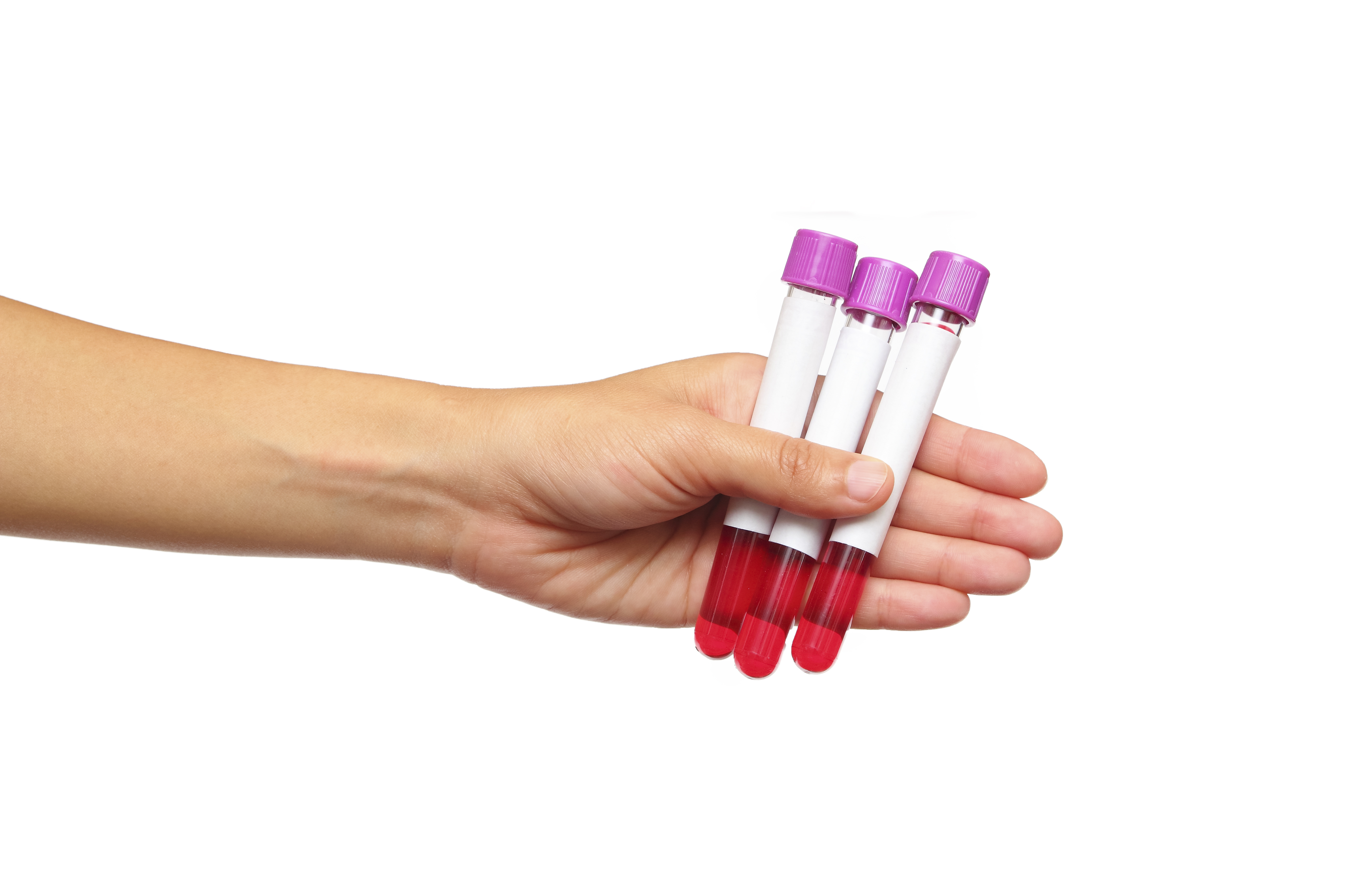 Gentest for FH blant familiemedlemmer kan tas ved en enkel blodprøve hos fastlegen. Bilde: Adobe Stock